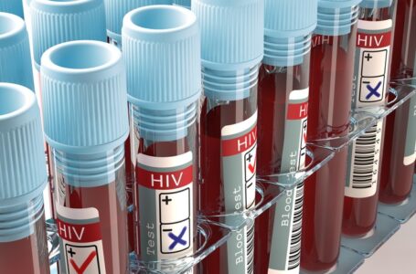 Mit HIV alt werden – Fortschritte in der AIDS-Therapie