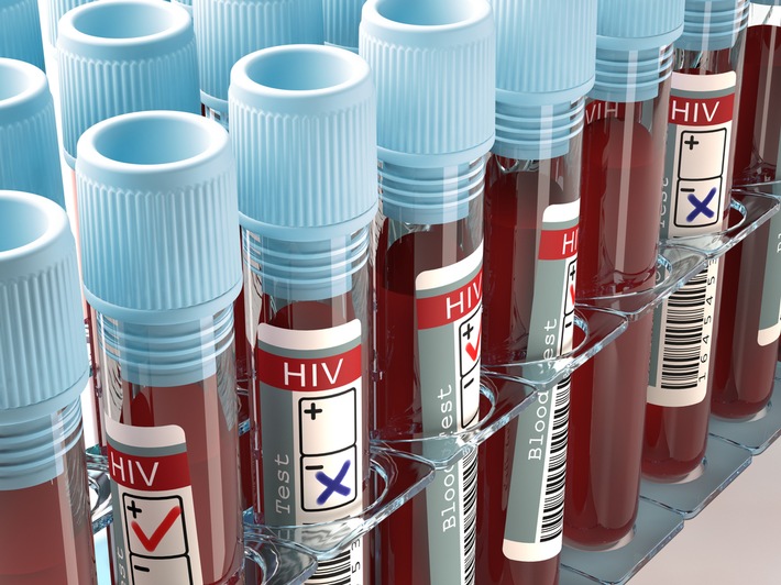 Mit HIV alt werden – Fortschritte in der AIDS-Therapie